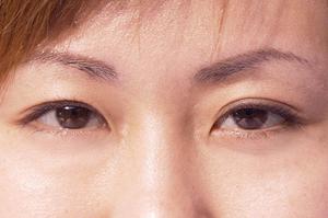 渋谷エステならリンパストレッチの追加も